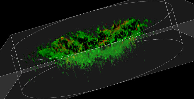 Zyncscan technology